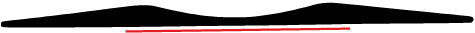 ADSL-1017